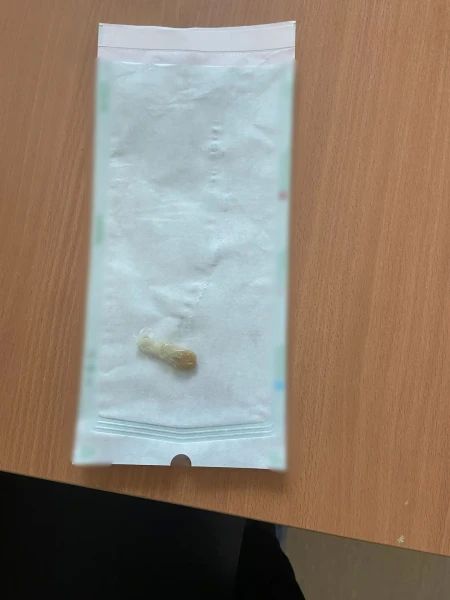 В Кургане задержана подозреваемая за покушение на незаконный сбыт сильнодействующего наркотика В Кургане задержана подозреваемая за покушение на незаконный сбыт сильнодействующего наркотика