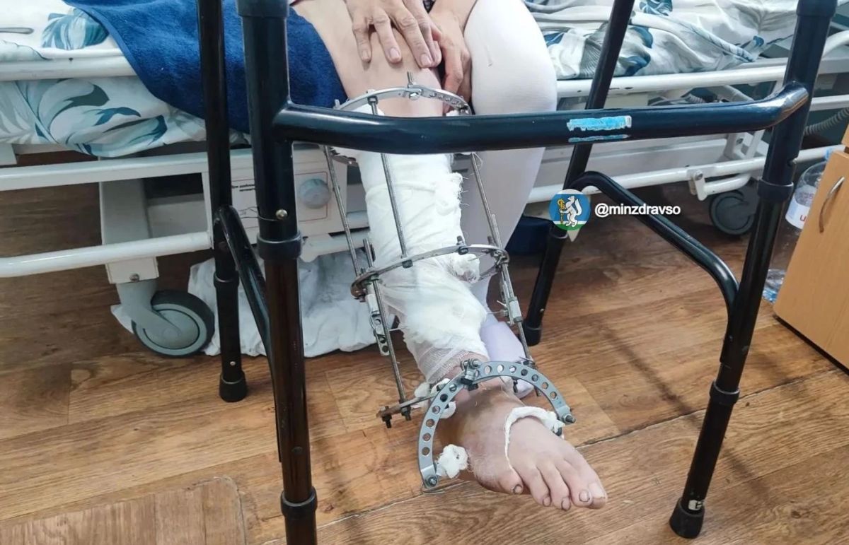 «Сделано в Кургане, спасено в Алапаевске»: как аппарат Илизарова вернул ногу женщине после встречи с мотоблоком «Сделано в Кургане, спасено в Алапаевске»: как аппарат Илизарова вернул ногу женщине после встречи с мотоблоком